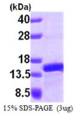 SDS-PAGE Recombinant Human PFDN1 His Protein