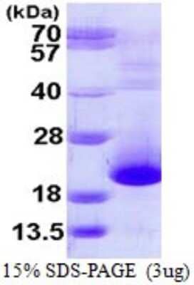 SDS-Page: Recombinant Human PFDN5 Protein [NBP1-72405] - 15% SDS-PAGE (3ug)