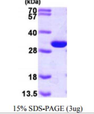 Recombinant Human PGAM1 Protein [NBP1-48341]