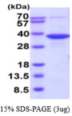 SDS-PAGE Recombinant Human PGPase His Protein