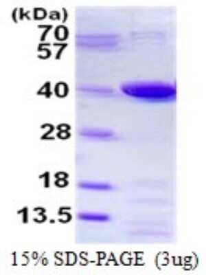 SDS-PAGE Recombinant Human PGR1 His Protein