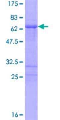 SDS-Page: Recombinant Human PHOX2A Protein [H00000401-P01] - 12.5% SDS-PAGE Stained with Coomassie Blue.