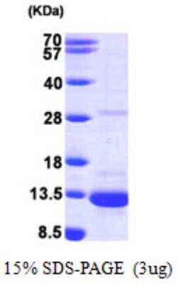 SDS-PAGE Recombinant Human PIN/DLC8 His Protein