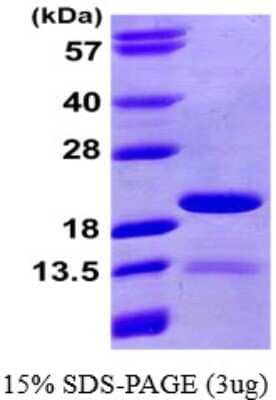 SDS-Page: Recombinant Human PIN4 Protein [NBP1-51068] - 15 % SDS-PAGE (3ug)