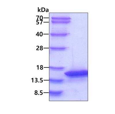 SDS-Page: Recombinant Human PKI-beta His Protein [NBP1-51058] - 3ug by SDS-PAGE under reducing condition and visualized by coomassie blue stain.