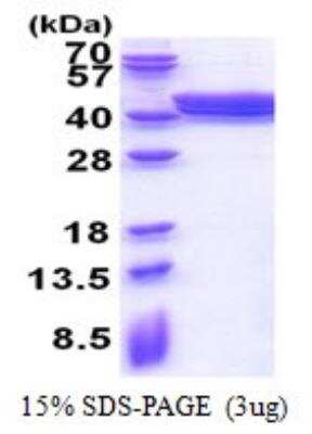 SDS-Page: Recombinant Human PLEKHF2 Protein [NBP2-51582]