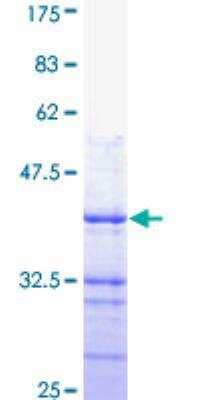 SDS-Page: Recombinant Human PMCA4 Protein [H00000493-Q01] - 12.5% SDS-PAGE Stained with Coomassie Blue.