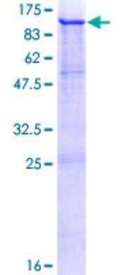 Recombinant Human PMEL17/SILV Protein [H00006490-P01] - 12.5% SDS-PAGE Stained with Coomassie Blue.