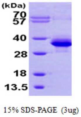 SDS-Page: Recombinant Human PMM1/Phosphomannomutase 1 Protein [NBP1-50868] - 15 % SDS-PAGE (3ug)