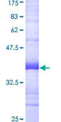 SDS-Page: Recombinant Human POLR3D Protein [H00000661-Q01] - 12.5% SDS-PAGE Stained with Coomassie Blue.