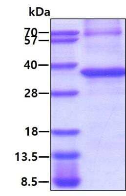 SDS-PAGE Recombinant Human PPM1D His Protein