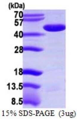 SDS-PAGE Recombinant Human PPME1 His Protein