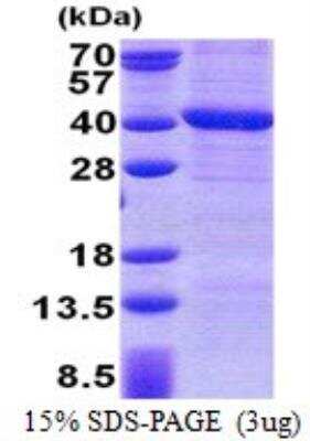 SDS-PAGE Recombinant Human PP4/PPP4C His Protein