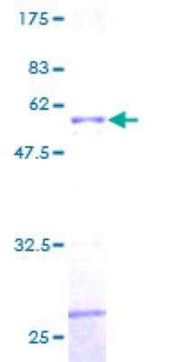 Recombinant Human PPP6C Protein [H00005537-P01] - 12.5% SDS-PAGE Stained with Coomassie Blue.
