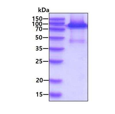 SDS-PAGE Recombinant Human PRMT1 His-MBP Protein