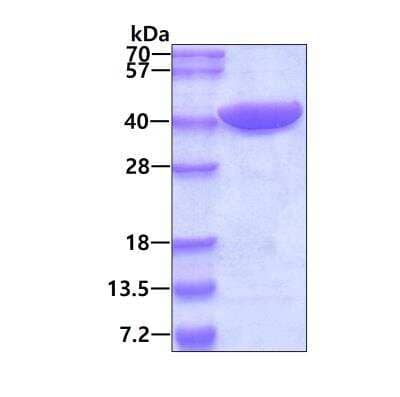 SDS-Page: Recombinant Human PRPS2 His Protein [NBP2-52113] - 3ug by SDS-PAGE under reducing condition and visualized by coomassie blue stain.