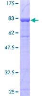 SDS-Page: Recombinant Human PSAP Protein [H00005660-P02] - 12.5% SDS-PAGE Stained with Coomassie Blue.