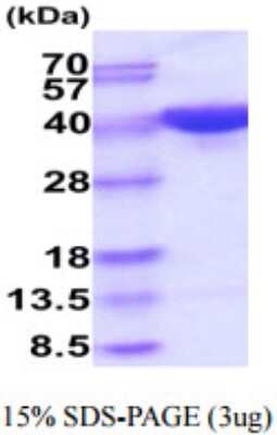 SDS-Page: Recombinant Human PSG5 Protein [NBP2-59885] - 15% SDS-PAGE