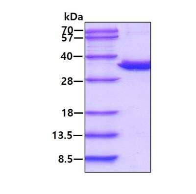 SDS-Page: Recombinant Human PSMA1 His Protein [NBP1-72482] - 3ug by SDS-PAGE under reducing condition and visualized by coomassie blue stain.