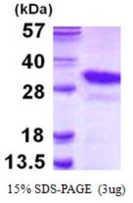 SDS-PAGE Recombinant Human PSMA8 His Protein