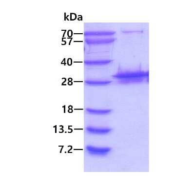 SDS-PAGE Recombinant Human PSMB10/MECL1 His Protein