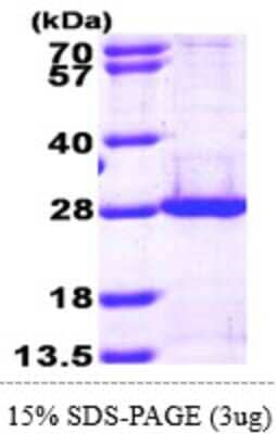 SDS-Page: Recombinant Human PSMB5 Protein [NBP1-50934] - 15 % SDS-PAGE (3ug)