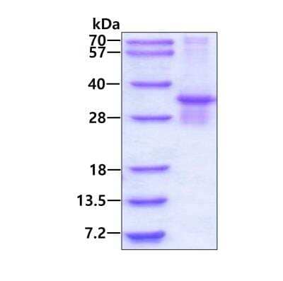 SDS-Page: Recombinant Human PSMB7 His Protein [NBP1-99093] - 3ug by SDS-PAGE under reducing condition and visualized by coomassie blue stain.