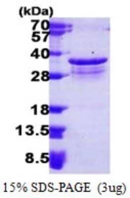 SDS-PAGE Recombinant Human PSMF1 His Protein