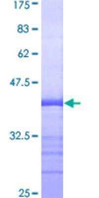 Recombinant Human PTK7/CCK4 Protein [H00005754-Q01] - 12.5% SDS-PAGE Stained with Coomassie Blue.
