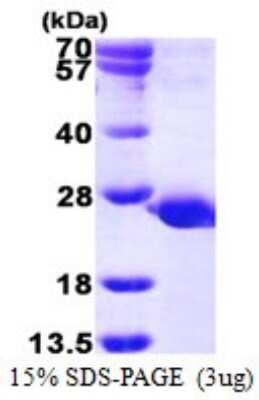 SDS-PAGE Recombinant Human PTPMT1 His Protein