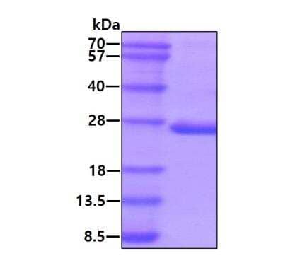 SDS-Page: Recombinant Human PTPMT1 Protein [NBP1-78852] - 3ug by SDS-PAGE under reducing condition and visualized by coomassie blue stain.