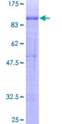 Recombinant Human PTPRO Protein [H00005800-P01] - 12.5% SDS-PAGE Stained with Coomassie Blue.