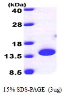 SDS-PAGE Recombinant Human PTRH2 His Protein