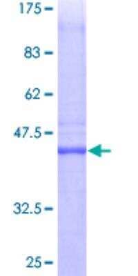 SDS-Page: Recombinant Human PTTG1IP Protein [H00000754-P01] - 12.5% SDS-PAGE Stained with Coomassie Blue.