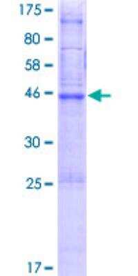 SDS-Page: Recombinant Human PTTG1IP Protein [H00000754-P02] - 12.5% SDS-PAGE Stained with Coomassie Blue.