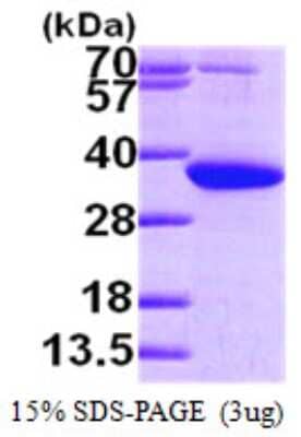 SDS-Page: Recombinant Human PYCR1 Protein [NBP1-50895] - 15 % SDS-PAGE (3ug)