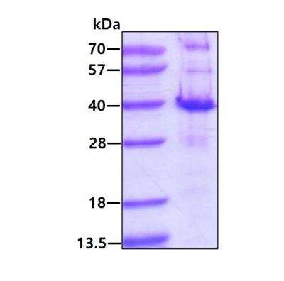 SDS-PAGE Recombinant Human PYCR2 His Protein