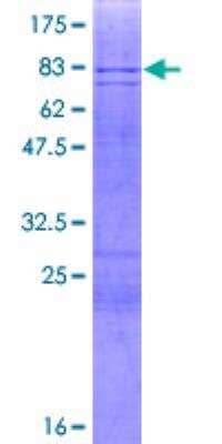 SDS-Page: Recombinant Human Pancreatic Amylase Beta Protein [H00000280-P02] - 12.5% SDS-PAGE Stained with Coomassie Blue.