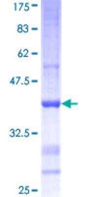 SDS-Page: Recombinant Human Pancreatic Amylase Beta Protein [H00000280-Q01] - 12.5% SDS-PAGE Stained with Coomassie Blue.