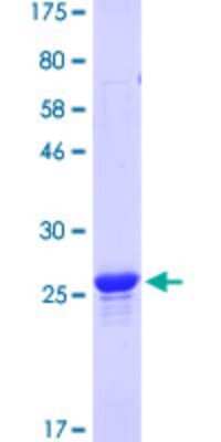 SDS-Page: Recombinant Human Paxillin Protein [H00005829-P03] - 12.5% SDS-PAGE Stained with Coomassie Blue.