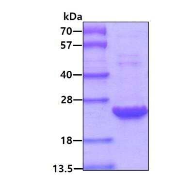 SDS-Page: Recombinant Human Peroxiredoxin 2 Protein [NBC1-25855] - 3ug by SDS-PAGE under reducing condition and visualized by coomassie blue stain.