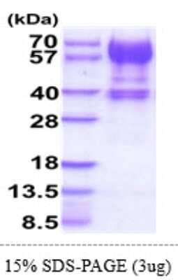 SDS-Page: Recombinant Human IL-15R alpha Protein [NBP2-61174] - 15 % SDS-PAGE (3ug)