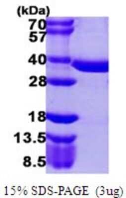 SDS-Page: Recombinant Human Phosphopantothenate-cysteine ligase Protein [NBP1-78806] - 15% SDS-PAGE (3ug)