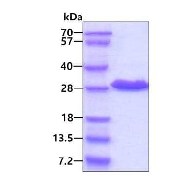 SDS-PAGE Recombinant Human Phosphoserine phosphatase Protein