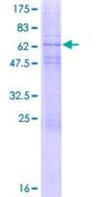 SDS-Page: Recombinant Human Podocin/NPHS2 Protein [H00007827-P01] - 12.5% SDS-PAGE Stained with Coomassie Blue.