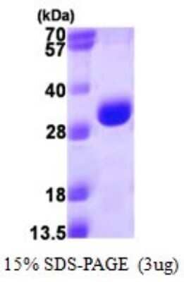 SDS-PAGE Recombinant Human Proteasome 20S alpha 3 His Protein