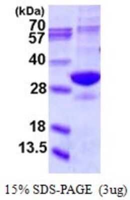 SDS-Page: Recombinant Human Proteasome 20S alpha 5 Protein [NBP1-78835] - 15% SDS-PAGE (3ug)