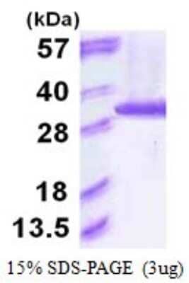 SDS-PAGE Recombinant Human Proteasome 20S alpha 6 His Protein