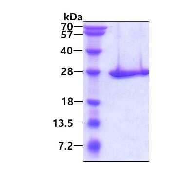 SDS-Page: Recombinant Human Proteasome 20S beta 3 His Protein [NBP1-72544] - 3ug by SDS-PAGE under reducing condition and visualized by coomassie blue stain.