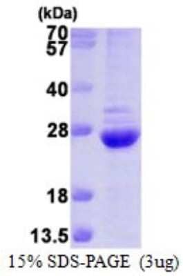 SDS-Page: Recombinant Human Proteasome 20S beta 6 Protein [NBP1-78850] - 15% SDS-PAGE (3ug)